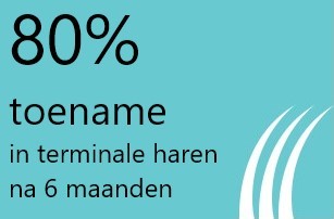 toename in terminale haren